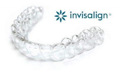 invisalign ortodoncia invisible madrid invisalign ortodoncia invisible madrid