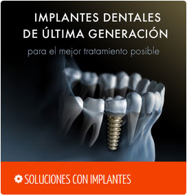 ofertas implantes dentales madrid ofertas implantes dentales madrid
