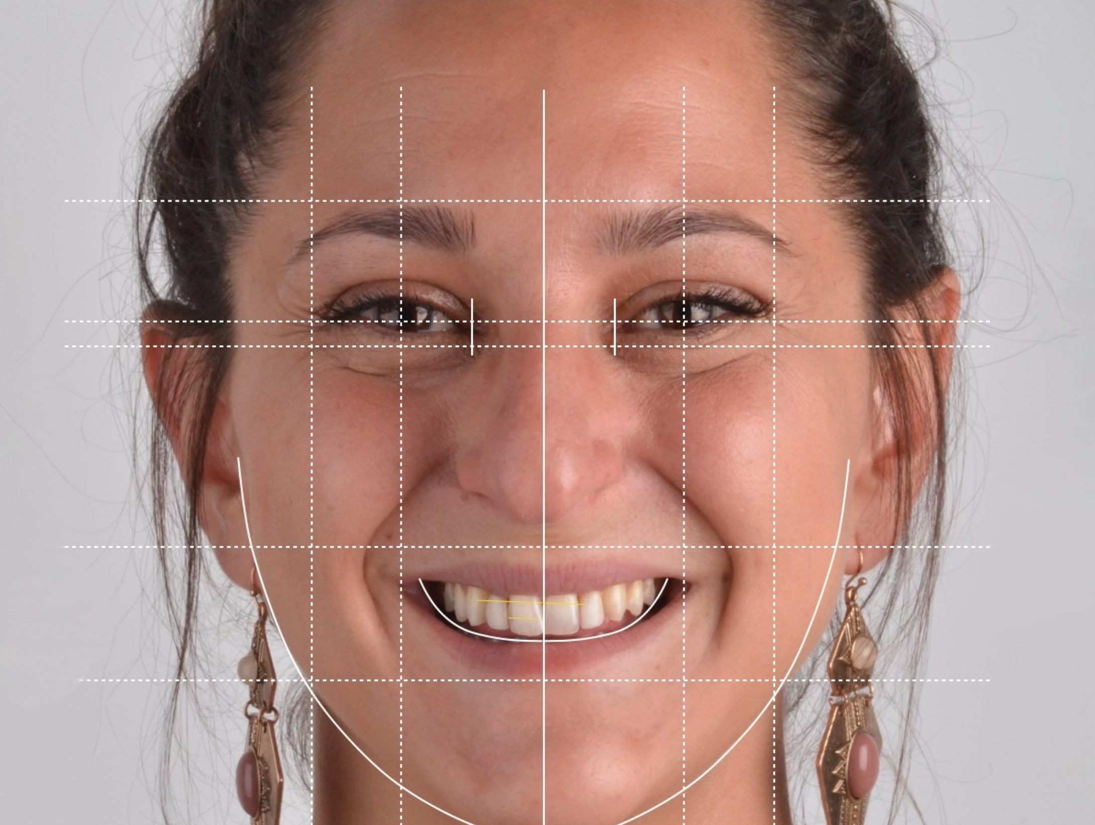 diseña tu sonrisa