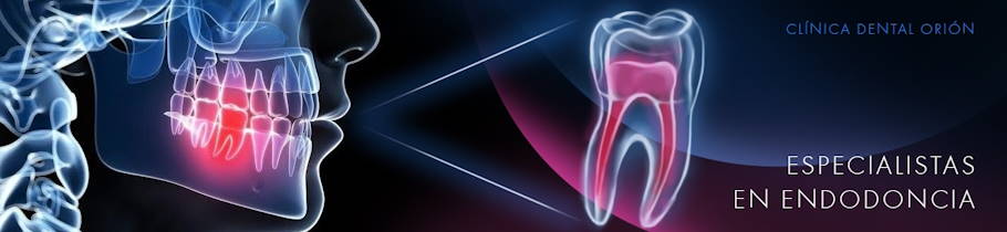 especialistas en endodoncia en madrid especialistas en endodoncia en madrid