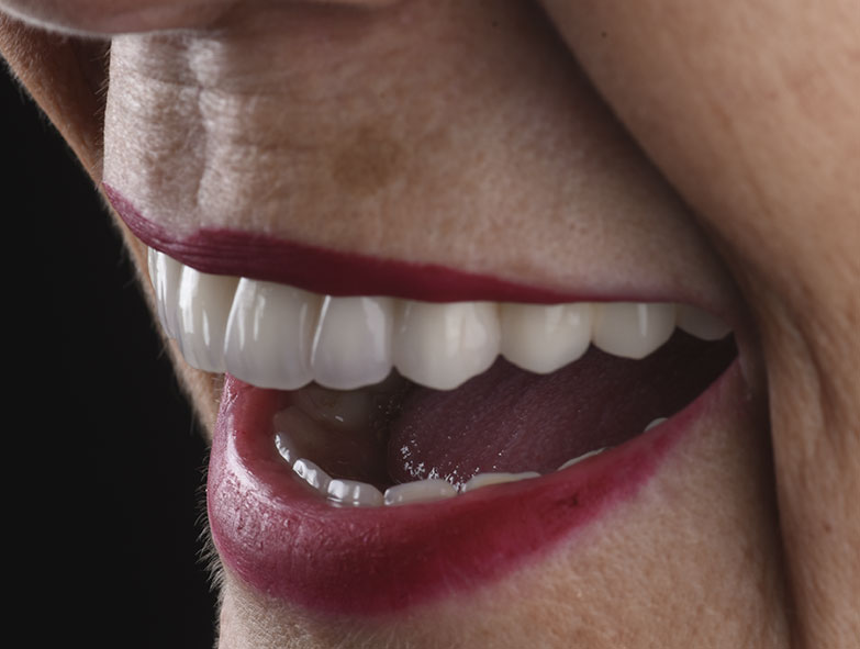 avances dentales madrid tecnologia avances dentales madrid tecnologia