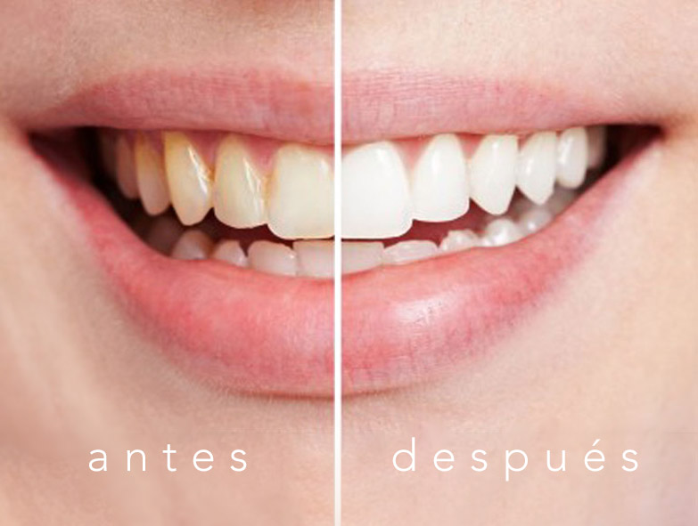 avances tecnologia dental avances tecnologia dental