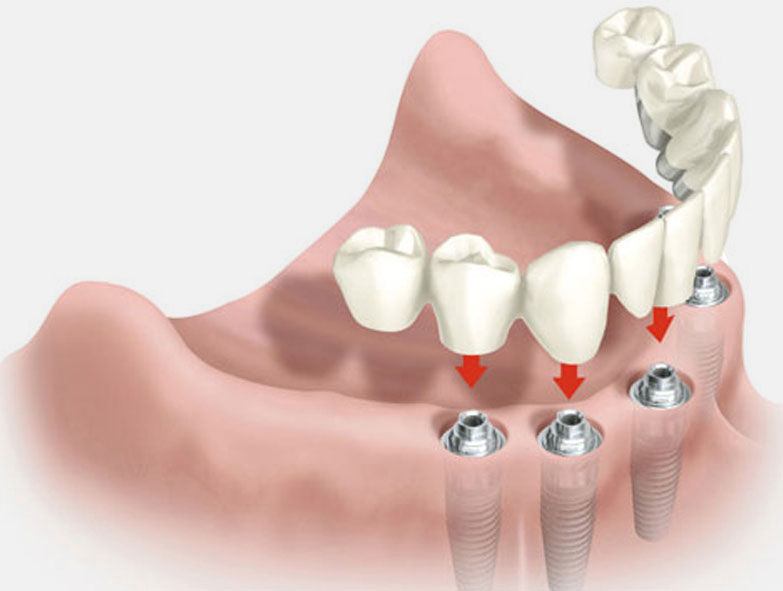 tecnologia dental tecnologia dental