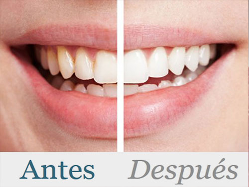 especilistas_estetica_dental_madrid