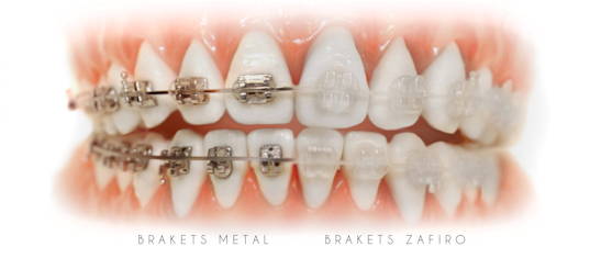 brackets_zafiro_precio_madrid brackets_zafiro_precio_madrid