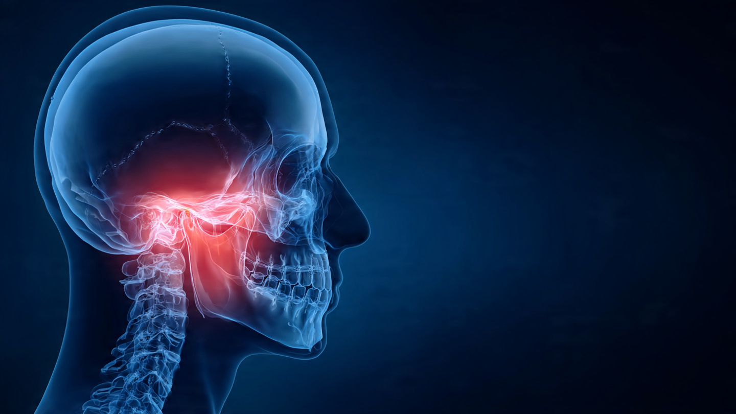 Diagrama de la articulación temporomandibular (ATM) afectada por la tensión de la onicofagia