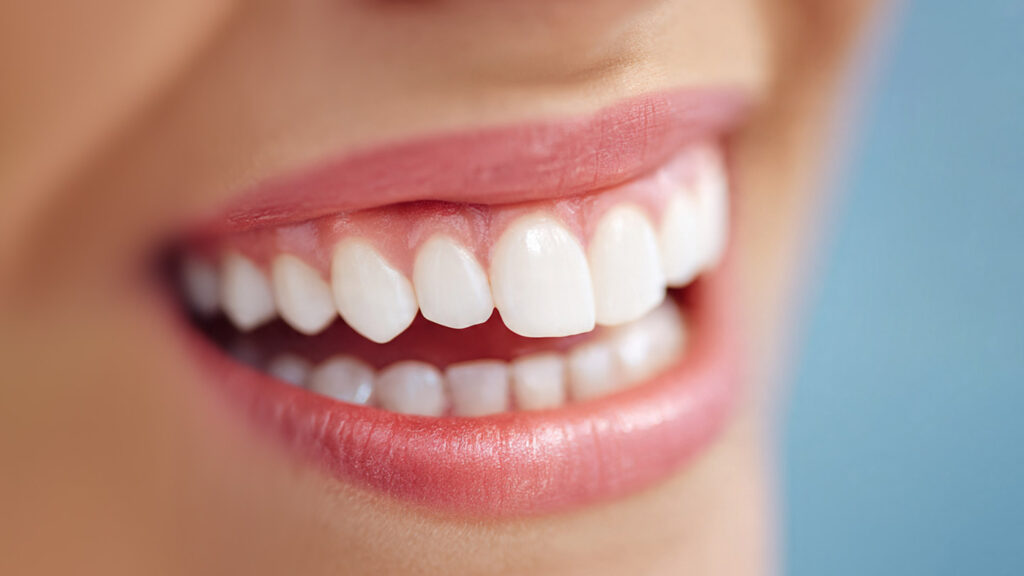 Sonrisa con encías sanas y rosadas tras tratamiento de estética dental en Clínica Orion Dental.