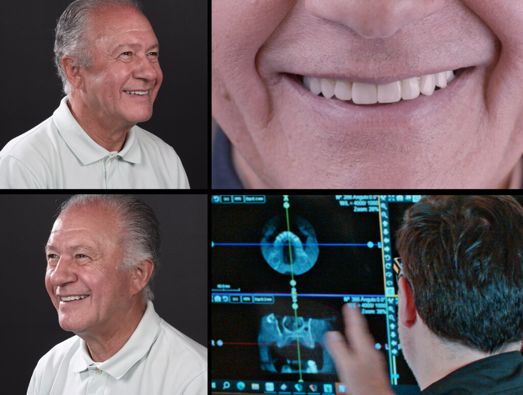 tecnologia dental 3d implantes madrid orion
