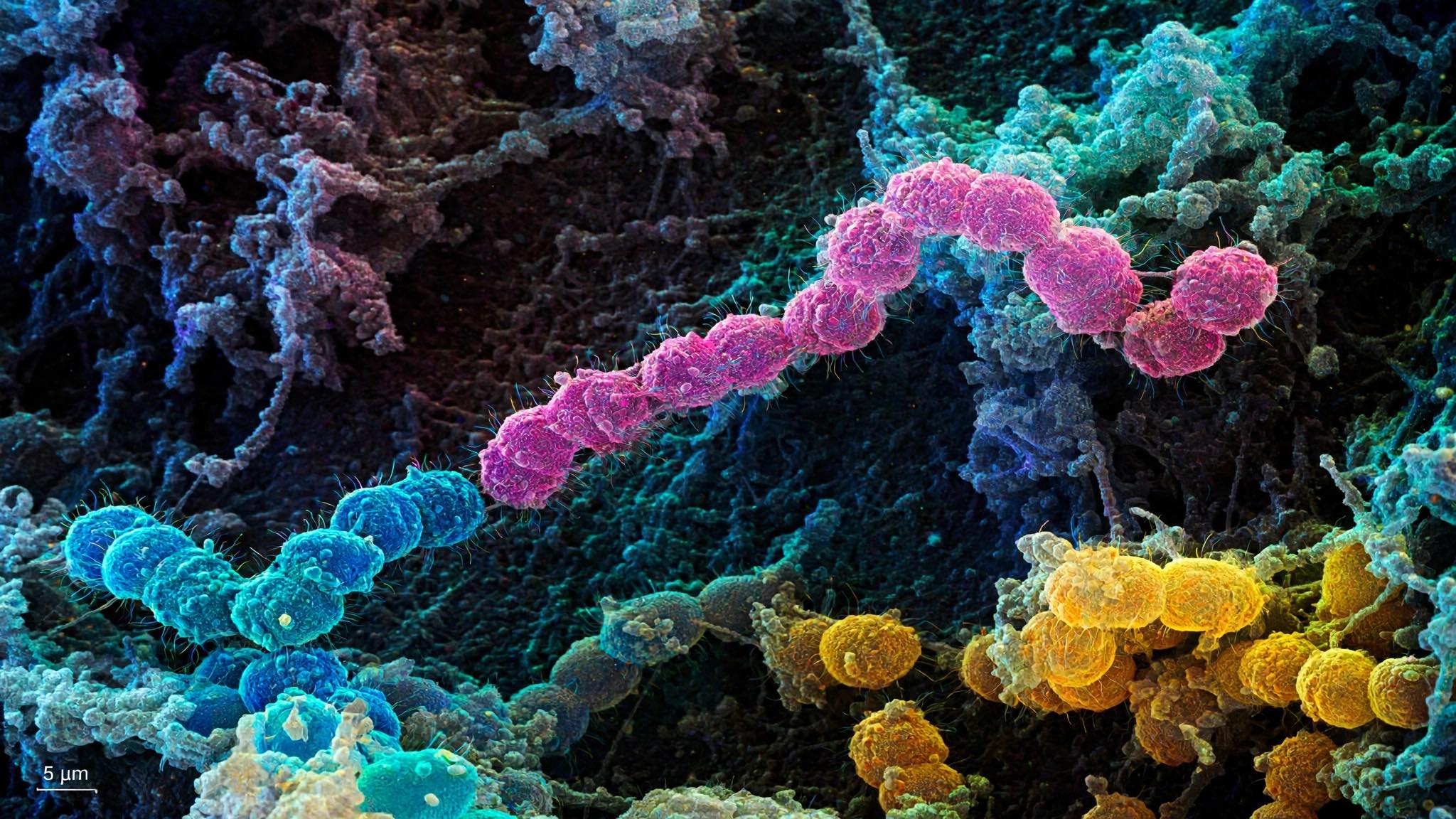 Bacterias Streptococcus mutans vistas al microscopio causantes de caries